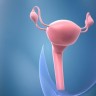 Erste Gebärmutter-Transplantation in den USA gescheitert
